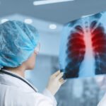 Tuberculosis resurges according to WHO.